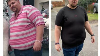 A before and after of a man standing facing the camera. The image on the right is of Shane 10 stone lighter